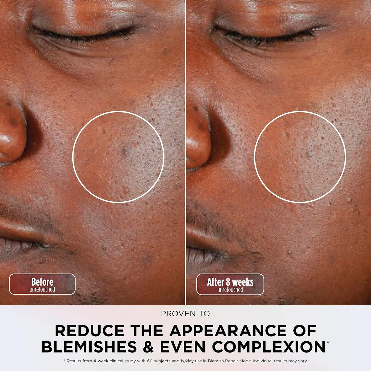 CryoGlow LED Face Mask with Under-Eye Cooling